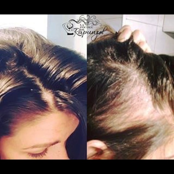 Pócima de Rapunzel (RAPUNZEL´S POTION) - Picture 3 of 7